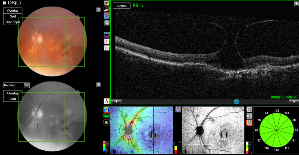 Additional de-identified fundus photograph and OCT retinal scans captured during the same eye examination